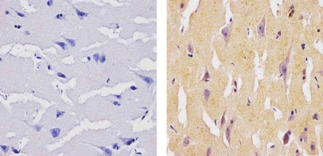 SOCS1 Antibody in Immunohistochemistry (Paraffin) (IHC (P))