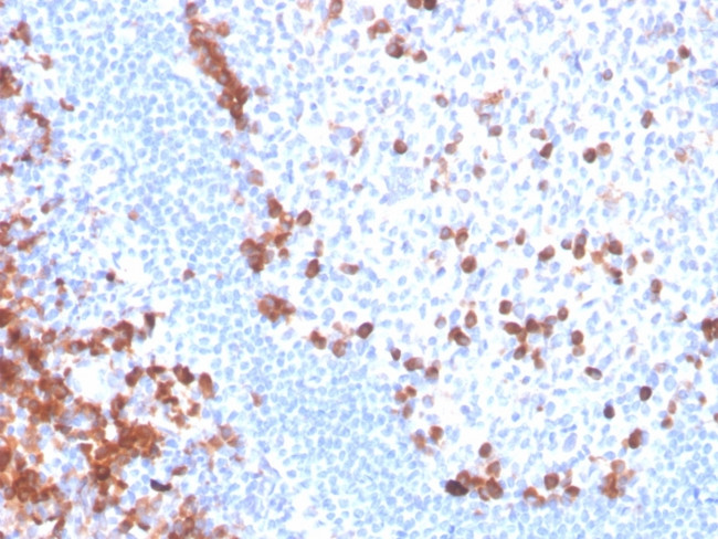 B7-H6/NCR3LG1 (Natural Killer Cell Cytotoxicity Receptor 3 Ligand 1) Antibody in Immunohistochemistry (Paraffin) (IHC (P))