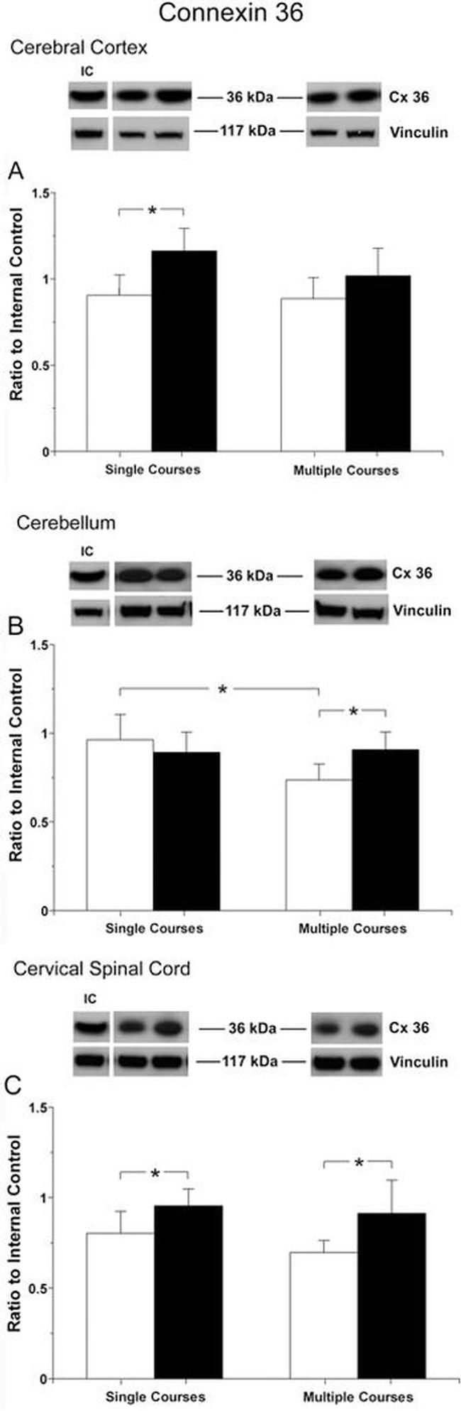 Connexin 36 Antibody in Western Blot (WB)