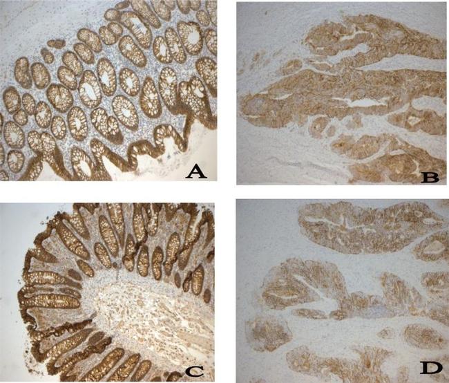 Claudin 7 Antibody in Immunohistochemistry (IHC)