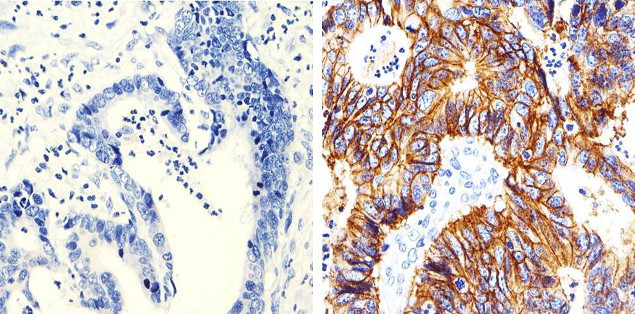 Claudin 7 Antibody in Immunohistochemistry (Paraffin) (IHC (P))