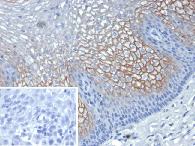 Suprabasin (SBSN) (CALB1) Antibody in Immunohistochemistry (Paraffin) (IHC (P))