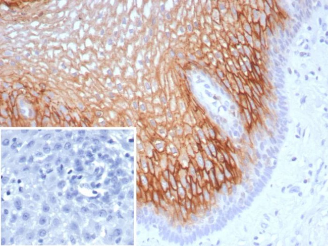 Suprabasin (SBSN) (CALB1) Antibody in Immunohistochemistry (Paraffin) (IHC (P))