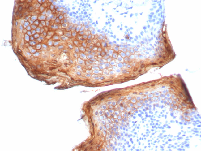 Suprabasin (SBSN) (CALB1) Antibody in Immunohistochemistry (Paraffin) (IHC (P))