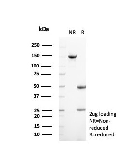 Suprabasin (SBSN) (CALB1) Antibody in SDS-PAGE (SDS-PAGE)