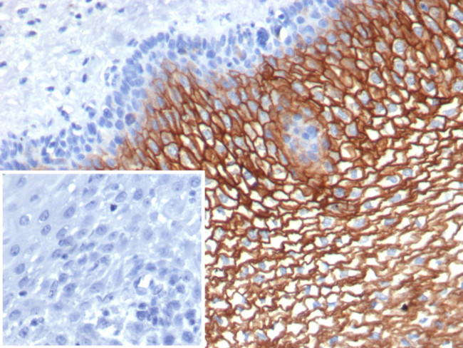 Suprabasin (SBSN) (CALB1) Antibody in Immunohistochemistry (Paraffin) (IHC (P))