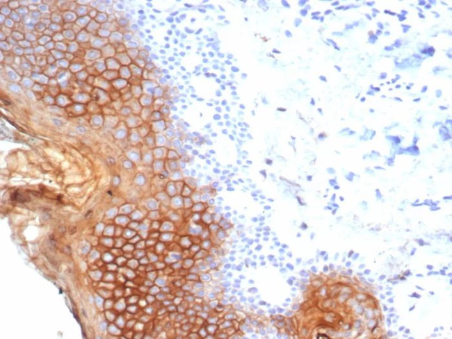 Suprabasin (SBSN) (CALB1) Antibody in Immunohistochemistry (Paraffin) (IHC (P))