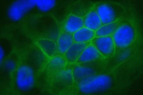 Claudin 1 Antibody in Immunocytochemistry (ICC/IF)