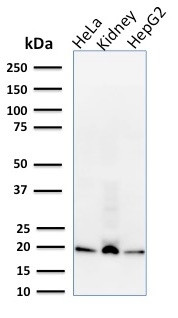 ARF1 (Golgi Apparatus Marker) Antibody in Western Blot (WB)