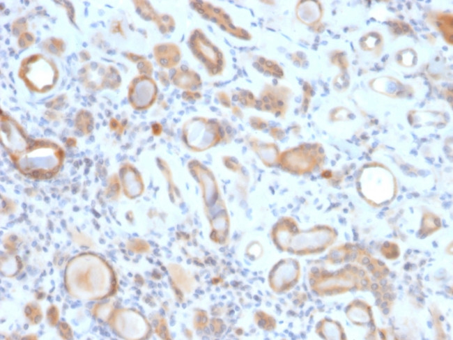 ARF1 (Golgi Apparatus Marker) Antibody in Immunohistochemistry (Paraffin) (IHC (P))