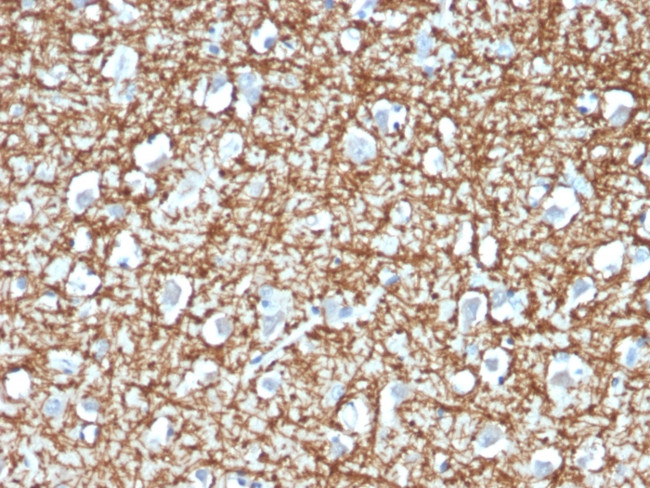 ARF1 (Golgi Apparatus Marker) Antibody in Immunohistochemistry (Paraffin) (IHC (P))