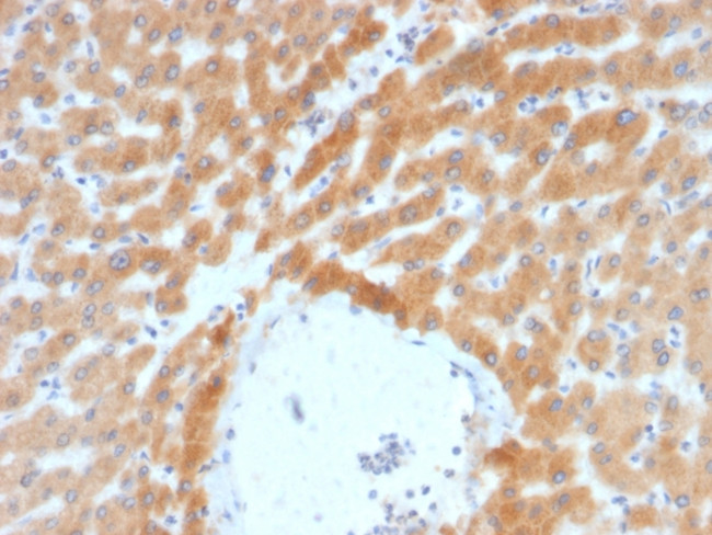 ARF1 (Golgi Apparatus Marker) Antibody in Immunohistochemistry (Paraffin) (IHC (P))