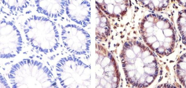 PLK1 Antibody in Immunohistochemistry (Paraffin) (IHC (P))