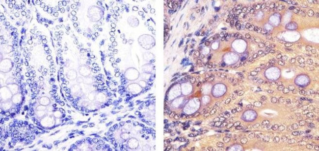 PLK1 Antibody in Immunohistochemistry (Paraffin) (IHC (P))