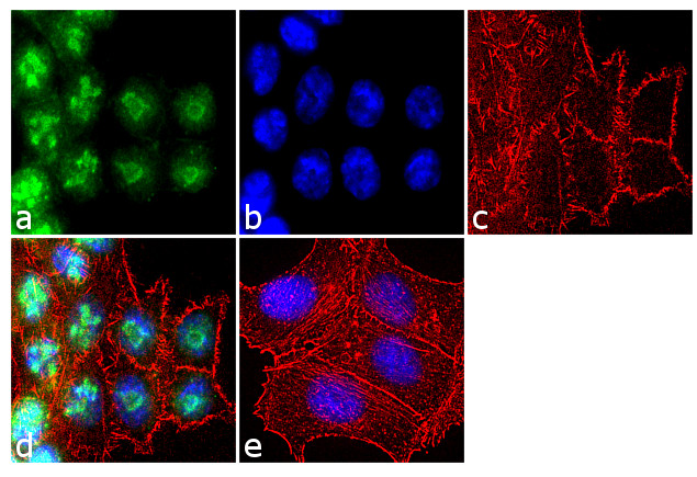 PLK1 Antibody in Immunocytochemistry (ICC/IF)