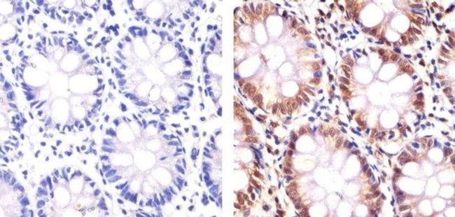 PLK1 Antibody in Immunohistochemistry (Paraffin) (IHC (P))