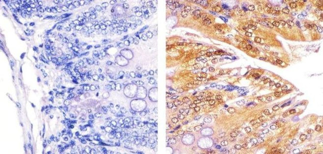 PLK1 Antibody in Immunohistochemistry (Paraffin) (IHC (P))