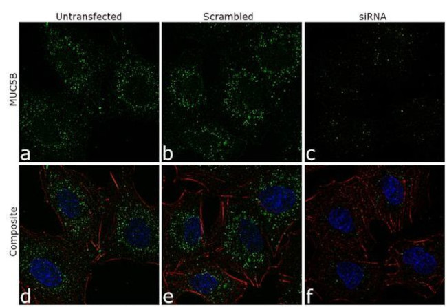 MUC5B Antibody in Immunocytochemistry (ICC/IF)