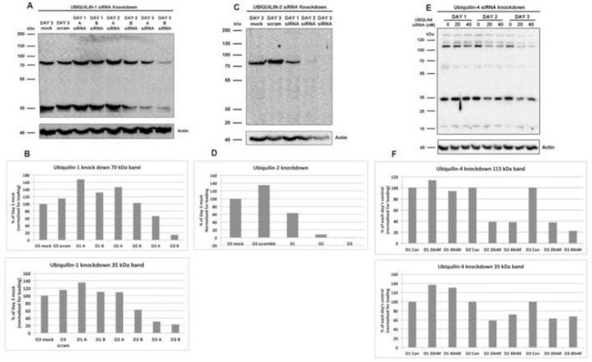 Ubiquilin 2 Antibody in Western Blot (WB)