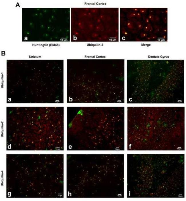 Ubiquilin 2 Antibody in Immunohistochemistry (IHC)