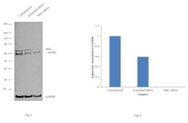 Ubiquilin 2 Antibody