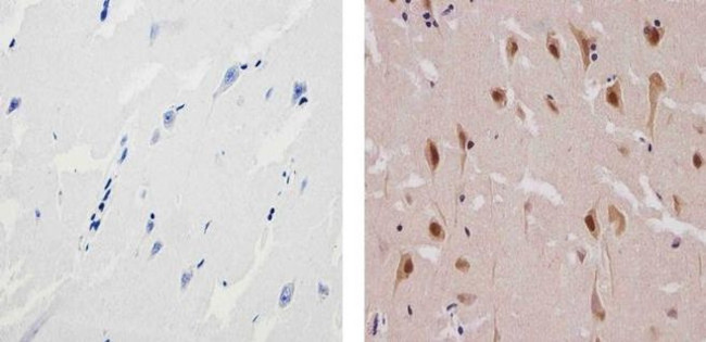 Ubiquilin 2 Antibody in Immunohistochemistry (Paraffin) (IHC (P))