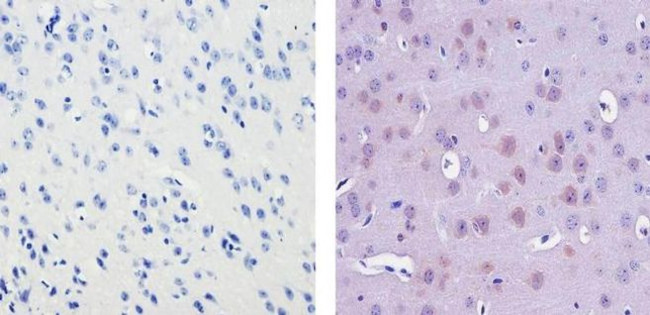 Ubiquilin 2 Antibody in Immunohistochemistry (Paraffin) (IHC (P))