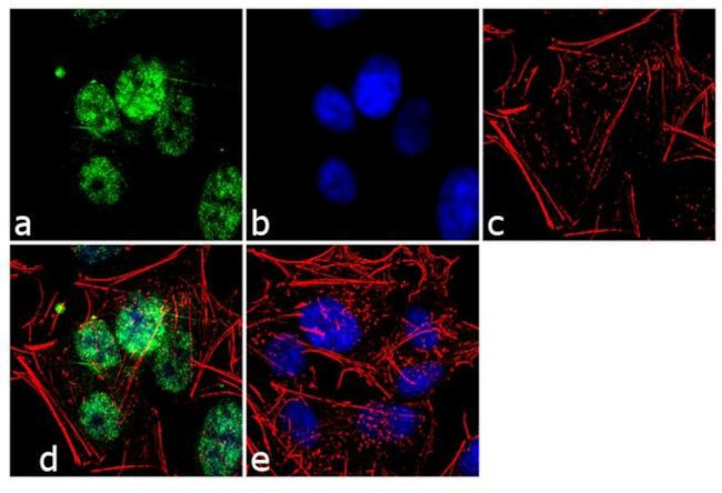 Ubiquilin 2 Antibody in Immunocytochemistry (ICC/IF)