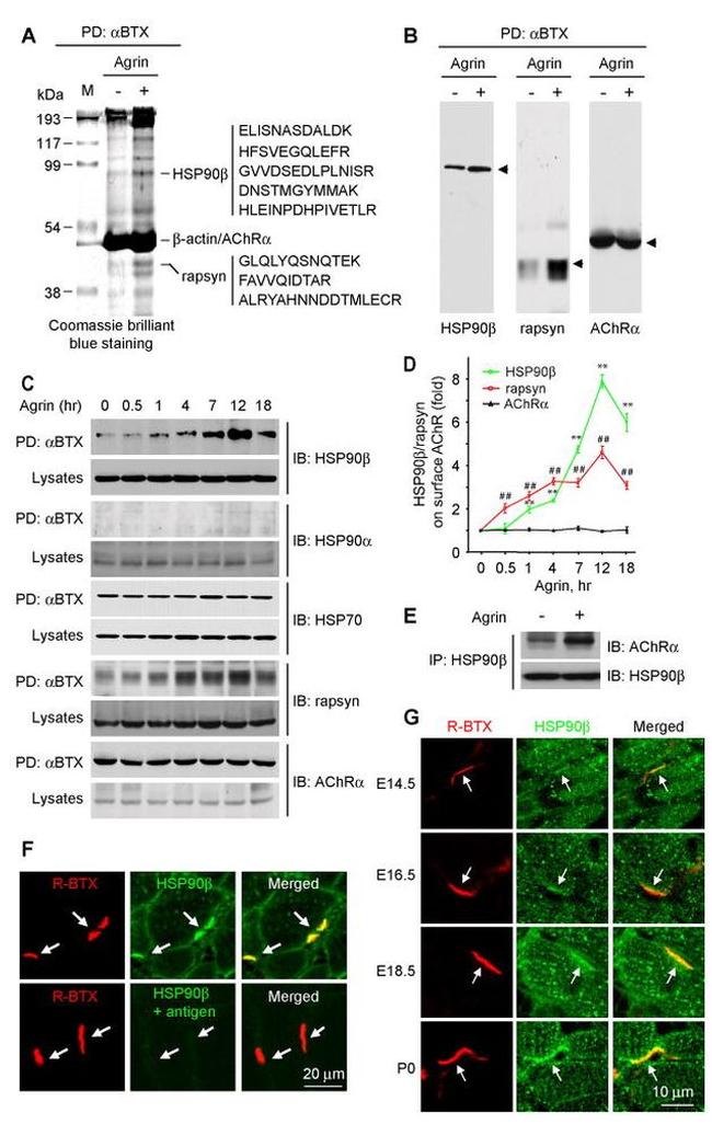 HSP90 beta Antibody in Western Blot, Immunocytochemistry, Immunoprecipitation (WB, ICC/IF, IP)