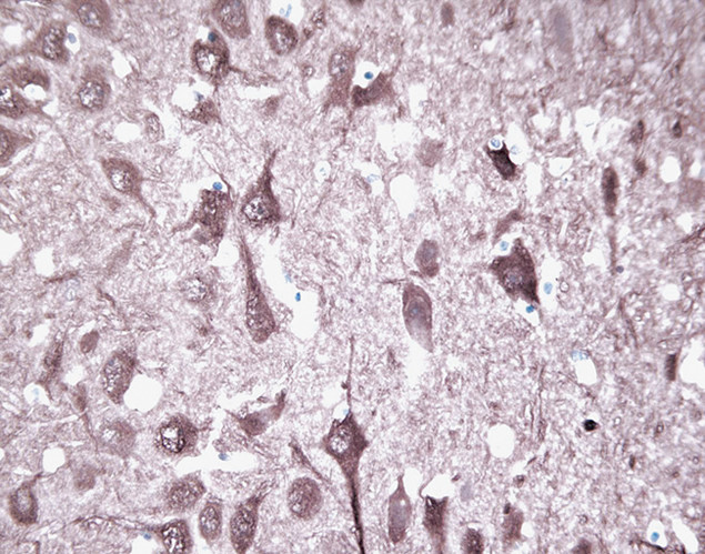 PGP9.5 Antibody in Immunohistochemistry (IHC)