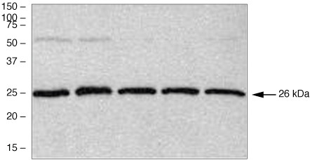 PGP9.5 Antibody in Western Blot (WB)