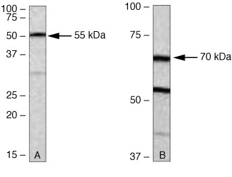 PKC zeta Antibody in Western Blot (WB)