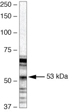 PAX3 Antibody in Western Blot (WB)