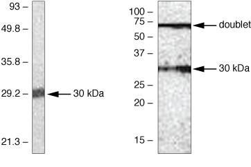 SOCS1 Antibody in Western Blot (WB)