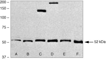 SMAD1 Antibody in Western Blot (WB)