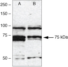 IRAK1 Antibody in Western Blot (WB)