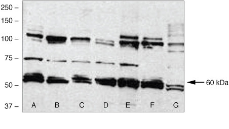 BMPR1A Antibody in Western Blot (WB)