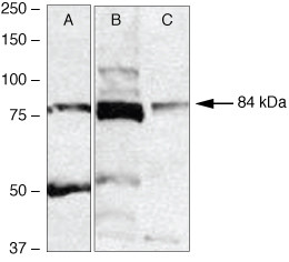 RSK2 Antibody in Western Blot (WB)