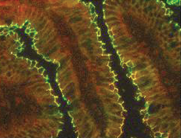 Claudin 15 Antibody in Immunohistochemistry (IHC)