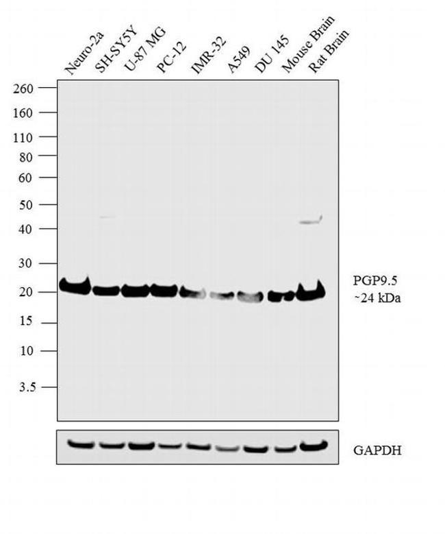 PGP9.5 Antibody in Western Blot (WB)