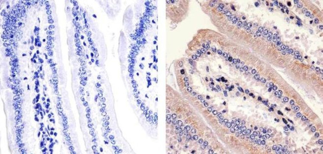 PKC zeta Antibody in Immunohistochemistry (Paraffin) (IHC (P))