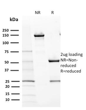 CD117/c-Kit (Marker for Gastrointestinal Stromal Tumors) Antibody in SDS-PAGE (SDS-PAGE)