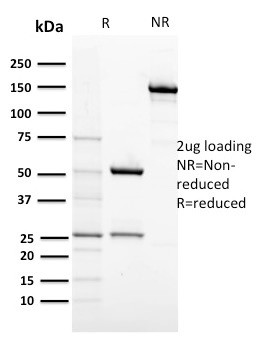 CD117/c-Kit (Marker for Gastrointestinal Stromal Tumors) Antibody in SDS-PAGE (SDS-PAGE)