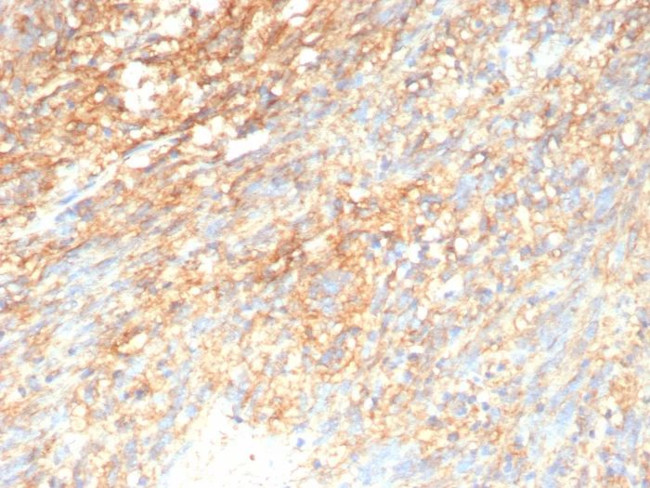 CD117/c-Kit (Marker for Gastrointestinal Stromal Tumors) Antibody in Immunohistochemistry (Paraffin) (IHC (P))