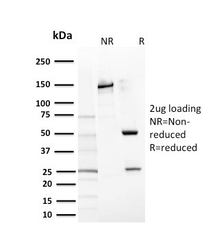 CD117/c-Kit (Marker for Gastrointestinal Stromal Tumors) Antibody in SDS-PAGE (SDS-PAGE)