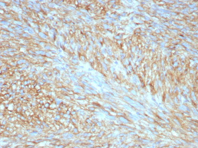 CD117/c-Kit (Marker for Gastrointestinal Stromal Tumors) Antibody in Immunohistochemistry (Paraffin) (IHC (P))