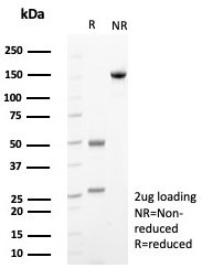 CD117/c-Kit (Marker for Gastrointestinal Stromal Tumors) Antibody in SDS-PAGE (SDS-PAGE)