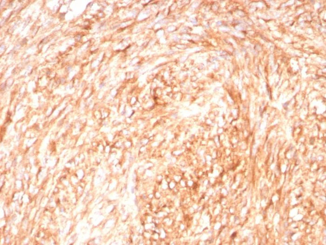 CD117/c-Kit (Marker for Gastrointestinal Stromal Tumors) Antibody in Immunohistochemistry (Paraffin) (IHC (P))