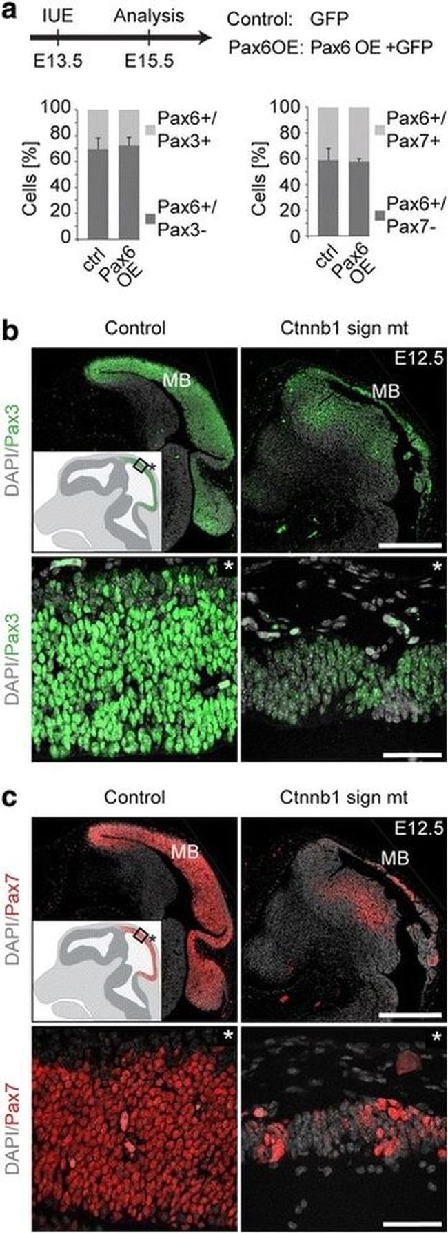 PAX3 Antibody in Immunohistochemistry (Paraffin) (IHC (P))