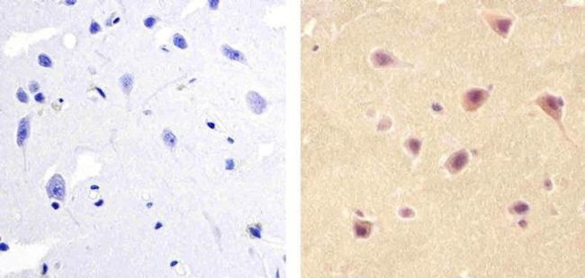 PAX3 Antibody in Immunohistochemistry (Paraffin) (IHC (P))